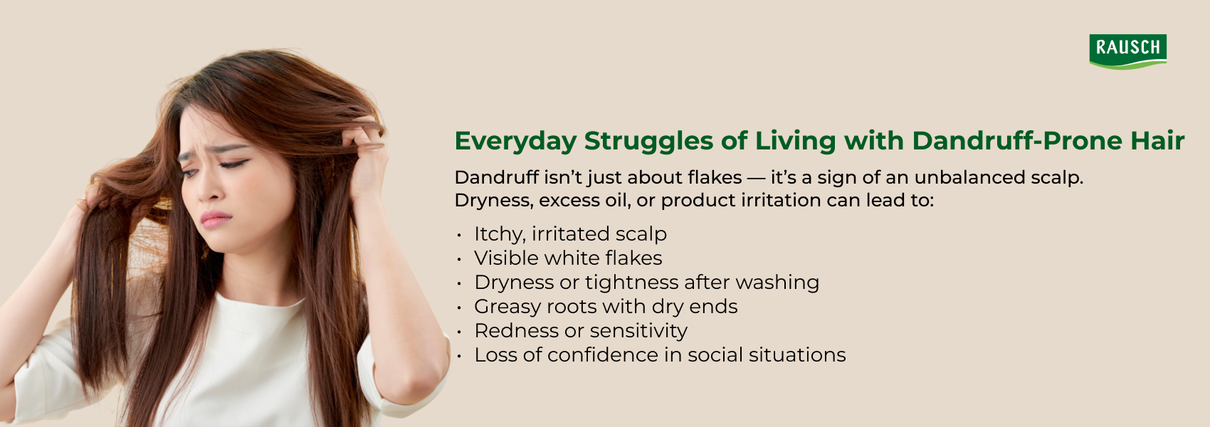 Say Goodbye to Dandruff Naturally