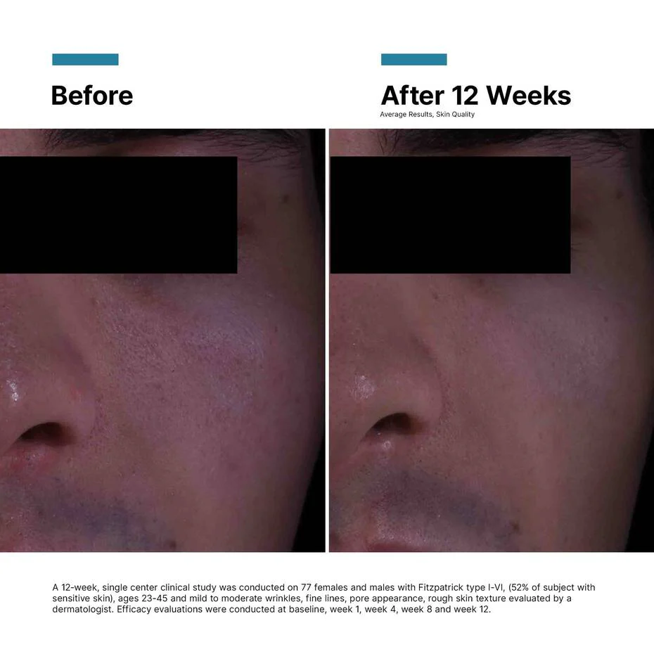 SkinCeuticals P-TIOX Anti-Wrinkle Cream 48ml - Image 10